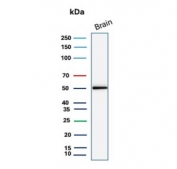 Western blot testing of human brain tissue lysate with Glial Fibrillary Acidic Protein antibody. Predicted molecular weight ~50 kDa.