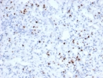 IHC staining of FFPE human tonsil tissue with recombinant GZMB antibody (clone rGZMB/6740). HIER: boil tissue sections in pH 9 10mM Tris with 1mM EDTA for 20 min and allow to cool before testing.