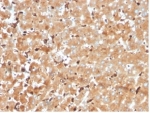 IHC staining of FFPE human liver tissue with Haptoglobin antibody (clone HP/3840) at 2ug/ml. HIER: boil tissue sections in pH 9 10mM Tris with 1mM EDTA for 20 min and allow to cool before testing.