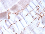 IHC staining of FFPE human skeletal muscle with recombinant Actin antibody (clone ACTA2/1614R). HIER: boil tissue sections in pH 9 10mM Tris with 1mM EDTA for 20 min and allow to cool before testing.