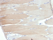 IHC staining of FFPE human skeletal muscle tissue with recombinant recombinant ACTN2 antibody (clone ACTN2/7039R). HIER: boil tissue sections in pH 9 10mM Tris with 1mM EDTA for 20 min and allow to cool before testing.