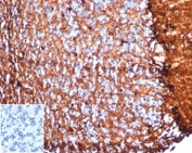 IHC staining of FFPE human brain tissue with S100B antibody (clone S100B/4153) at 2ug/ml. Inset: PBS instead of primary antibody, secondary negative control. HIER: boil tissue sections in pH 9 10mM Tris with 1mM EDTA for 20 min and allow to cool before testing.