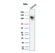 Western blot testing of human kidney tissue lysate with recombinant Cadherin 16 antibody. Expected molecular weight: 90~130 kDa.