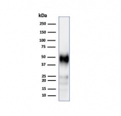 Western blot testing of human Jurkat cell lysate using recombinant CD2 antibody (clone LFA2/3417R). Expected molecular weight ~47 kDa.