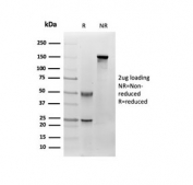 SDS-PAGE analysis of purified, BSA-free Fibroblast Activation Protein Alpha antibody (clone FAP/4851) as confirmation of integrity and purity.