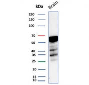 Western blot testing of human brain tissue lysate using recombinant ALDH1A1 antibody (clone rALDH1A1/7285). Expected molecular weight ~55 kDa.