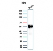 Western blot testing of human brain tissue with GFAP antibody. Predicted molecular weight ~50 kDa.