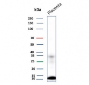 Western blot testing of human placental tissue lysate with MCP2 antibody. Predicted molecular weight ~11 kDa, higher molecular weight bands may represent dimerization.