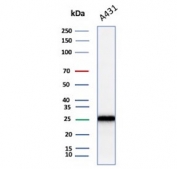 Western blot testing of human A431 cell lysate with recombinant p27Kip1 antibody. Expected molecular weight ~27 kDa.