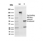 SDS-PAGE analysis of purified, BSA-free Apolipoprotein D antibody (clone APOD/3413) as confirmation of integrity and purity.