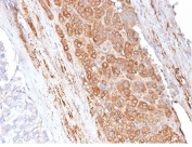 SDS-PAGE analysis of purified, BSA-free Apolipoprotein E antibody (clone APOE/3671) as confirmation of integrity and purity.