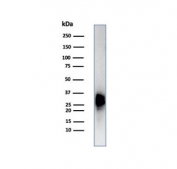 Western blot testing of human testis tissue lysate using Calbindin 2 antibody (clone CALB2/7029R). Predicted molecular weight ~29 kDa.