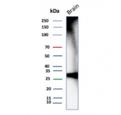 Western blot testing of human brain tissue lysate using Calbindin 2 antibody (clone CALB2/7029R). Predicted molecular weight ~29 kDa.