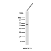 Western blot testing of human serum lysate with human IgA antibody (clone IGHA/3877R).