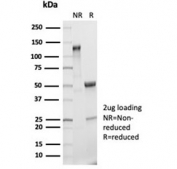 SDS-PAGE analysis of purified, BSA-free recombinant IL-2 antibody (clone IL2/7050R) as confirmation of integrity and purity.