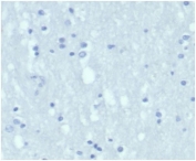 Negative control: IHC staining of FFPE human brain tissue with recombinant KRT7 antibody (clone KRT7/4387R) at 2ug/ml in PBS for 30min RT. HIER: boil tissue sections in pH 9 10mM Tris with 1mM EDTA for 20 min and allow to cool before testing.