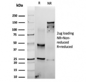 SDS-PAGE analysis of purified, BSA-free recombinant FSCN1 antibody (clone rFSCN1/6464) as confirmation of integrity and purity.