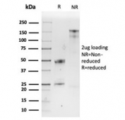  SDS-PAGE analysis of purified, BSA-free SPARC antibody (clone OSTN/3932) as confirmation of integrity and purity.