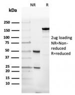 SDS-PAGE analysis of purified, BSA-free Alpha II Spectrin antibody (clone SPTAN1/3507) as confirmation of integrity and purity.