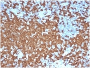 IHC staining of FFPE human tonsil tissue with recombinant ZAP70 antibody (clone ZAP70/6492R). HIER: boil tissue sections in pH 9 10mM Tris with 1mM EDTA for 20 min and allow to cool before testing.