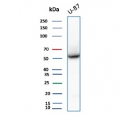 Western blot testing of human U-87 MG cell lysate using recombinant VIM antibody (clone rVIM/6914). Predicted molecular weight ~53 kDa.