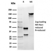 SDS-PAGE analysis of purified, BSA-free Angiotensin Converting Enzyme antibody (clone ACE/3764) as confirmation of integrity and purity.