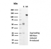 SDS-PAGE analysis of purified, BSA-free recombinant HSP27 antibody (clone HSPB1/7038R) as confirmation of integrity and purity.