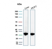 Western blot testing of human liver and MCF7 cell lysate with recombinant HSP27 antibody (clone HSPB1/7038R). Predicted molecular weight: 23-27 kDa.