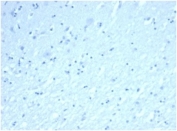 Negative control: IHC staining of FFPE human brain tissue using recombinant INHA antibody (clone rINHA/6919at 2ug/ml in PBS for 30min RT. HIER: boil tissue sections in pH 9 10mM Tris with 1mM EDTA for 20 min and allow to cool before testing.