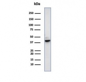 Western blot testing of human PC3 cell lysate using SERPINB5 antibody (clone SERPINB5/4979). Predicted molecular weight: 42~45 kDa.