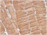 IHC staining of FFPE human skeletal muscle with Actin alpha 1 antibody (clone ACTA1/360). HIER: boil tissue sections in pH 9 10mM Tris with 1mM EDTA for 20 min and allow to cool before testing.
