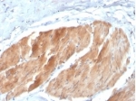 IHC staining of FFPE human bladder tissue with PIK3R2 antibody (clone PIK3R2/1293). HIER: boil tissue sections in pH 9 10mM Tris with 1mM EDTA for 20 min and allow to cool before testing.
