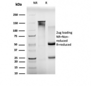 SDS-PAGE analysis of purified, BSA-free B-cell lymphoma/leukemia 11A antibody (clone PCRP-BCL11A-1H3) as confirmation of integrity and purity.