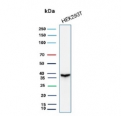 Western blot testing of human 293T cell lysate with recombinant Aldose reductase 1B1 antibody (clone rAKR1B1/7296). Predicted molecular weight ~36 kDa.