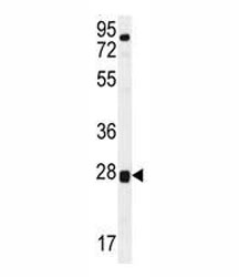 TOR2A antibody western blot analysis in human placenta tissue lysate.