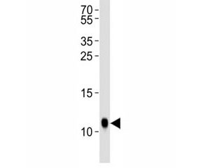 Western blot analysis of lysate from Drosophila tissue lysate using SUMO antibody diluted at 1:1000.