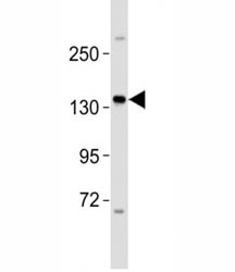 Western blot testing of ERBB4 antibody at 1:2000 dilution + MCF-7 lysate; Predicted molecular weight: 147-180 kDa (precursor), 120, 80 kDa (cleaved forms).