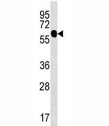 ZFP64 antibody western blot analysis in uterus tissue lysate