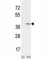 Western blot analysis of CCND1 antibody ans 293 cell lysate (2 ug/lane) either nontransfected (Lane 1) or transiently transfected with the CCND1 gene (2). Predicted molecular weight: 32-36 kDa.