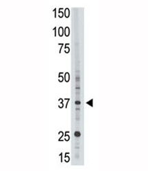 EPR1 antibody used in western blot to detect EPR1 in HL-60 cell lysate