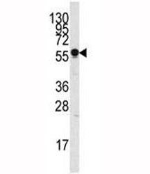 Western blot analysis of SIGLEC7 antibody and NCI-H460 lysate.