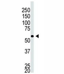Western blot testing of BACE2C antibody and A549 cell lysate