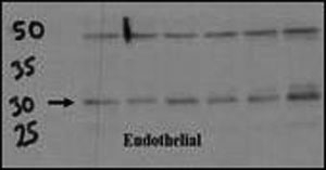 Endothelial cell lysate transferred to membrane was incubated with DSCR1 antibody at a 1:500 dilution. Data courtesy of Dr. Katherine Healey, NWCRF Institute, School of Biological Sciences, University of Wales Bangor.