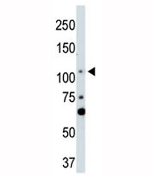 LATS2 antibody used in western blot to detect LATS2 in NIH3T3 cell lysate