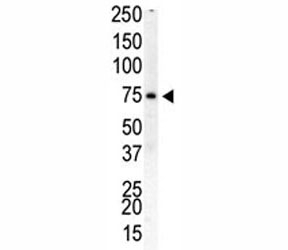 Western blot analysis of PIP5K1B antibody and human placenta cell lysate