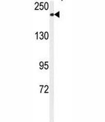 Western blot analysis of CHAK1 / TRPM7 antibody and mouse kidney tissue lysate.