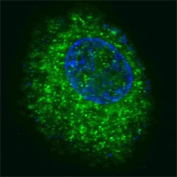Fluorescent confocal image of HepG2 cells stained with HGFR antibody.  HGFR is localized to the cytoplasm