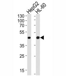 Western blot analysis of lysate from HepG2, HL-60 cell line (left to right) using beta-Actin antibody at 1:1000 for each lane.