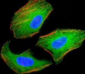 Fluorescent image of HeLa cells stained with TSC2 antibody. Alexa Fluor 488 secondary (green), cytoplasmic actin (red) and nuclei counterstained with DAPI (blue) were used. TSC2 immunoreactivity is localized to the microtubules.