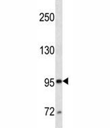 CD10 antibody western blot analysis in CEM lysate.